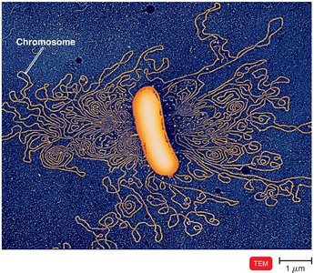 TEM image of E. coli chromosome