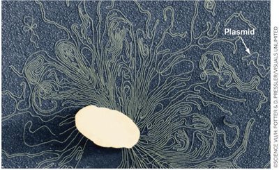 TEM image showing plasmid