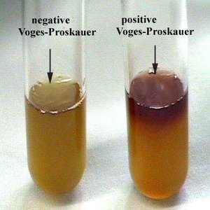 Voges-Proskauer test: negative (no color change) and positive (red) results
