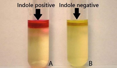 Indole test: positive (red ring) and negative (yellow) results