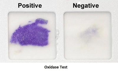 Oxidase test: positive (purple) and negative (no color) results