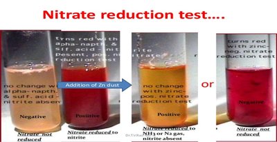 Nitrate reduction test: negative, positive, and further reduced results