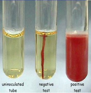 Motility test: uninoculated, negative (growth only on stab line), positive (diffuse growth)