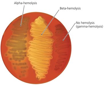 Blood agar showing types of hemolysis