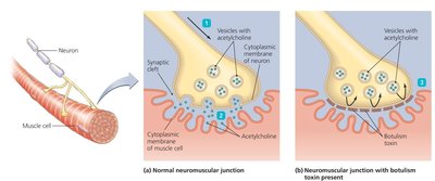 Comparison of botulinum and tetanus toxin effects