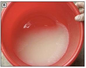 Rice water stool, a symptom of cholera