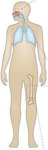 Diagram of local and systemic infection in the body