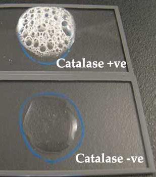 Capsule structure and function in immune evasion