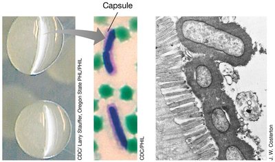 Bacillus anthracis with capsule