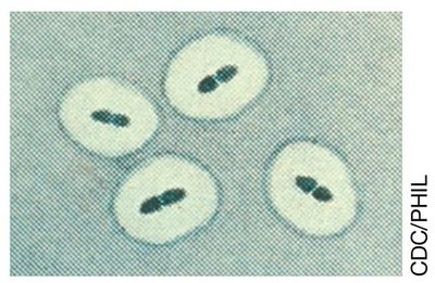 Streptococcus pneumoniae with capsule