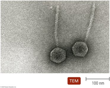 Transmission electron micrograph of bacteriophages