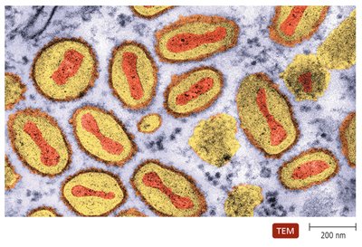 TEM of poxvirus particles