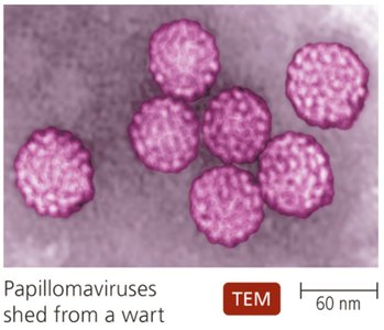 TEM of papillomaviruses shed from a wart