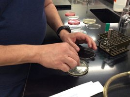 Sampling under the nails for microorganisms