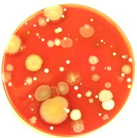 Blood agar plate showing diverse microbial colonies