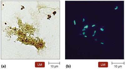 Fluorescence microscopy: normal light vs. UV light