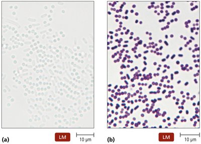 Comparison of stained and unstained cells under a light microscope