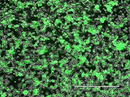 Cell culture with GFP-labeled adenovirus