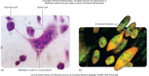 Cytopathic effects: syncytia and inclusion bodies