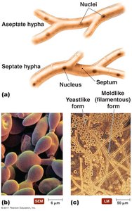 Diagram showing fungal hyphae and yeastlike forms