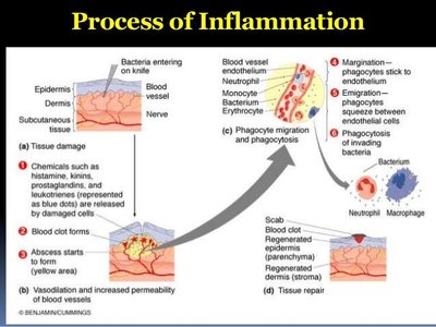 Process of inflammation diagram