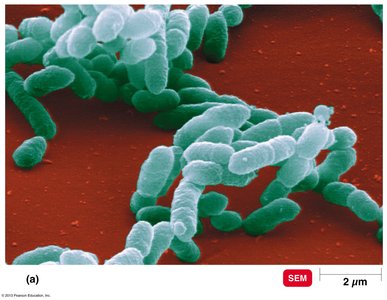 Rod-shaped bacterium Haemophilus influenzae