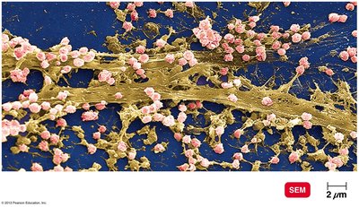 Biofilm on a catheter