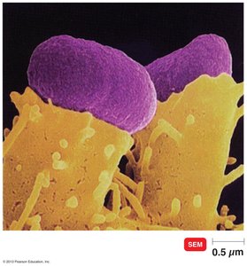 Pedestal formation by Enterhemorrhagic E. coli (EHEC) O157:H7