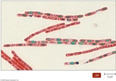 Schaeffer-Fulton stained Bacillus anthracis with endospores