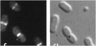 Fluorescence and phase contrast images showing FtsZ and MreB localization in bacteria