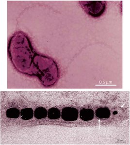 Electron micrograph of magnetosomes in bacteria