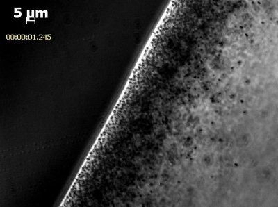 Electron micrograph showing magnetosome alignment