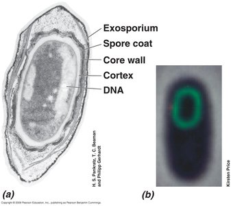 Electron micrograph of bacterial endospore structure