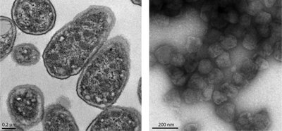 Electron micrographs of bacterial microcompartments