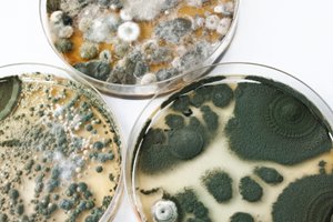 Yeast cells under microscope