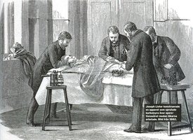 Historical depiction of Lister's antiseptic surgery