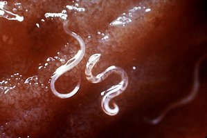 Hookworms attached to intestinal mucosa