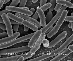 Electron micrograph of bacteria