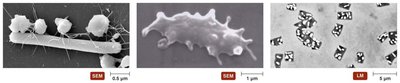 Representative shapes of archaea