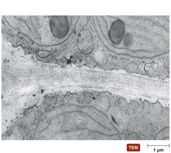 Eukaryotic cell wall structure