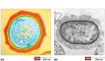 Glycocalyx: capsule and slime layer