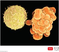 Apoptosis