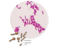 Clostridium tetani endospores and vegetative cells