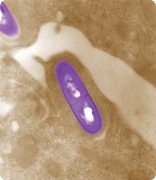 Listeria monocytogenes under electron microscope