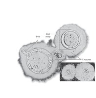 Cryptococcus neoformans with capsule