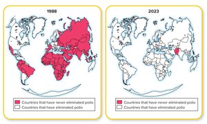 Global eradication progress of polio, 1988 vs 2023