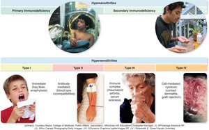 Summary diagram of hypersensitivities and immunodeficiencies