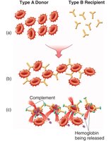 Mechanism of transfusion reaction in Type II hypersensitivity