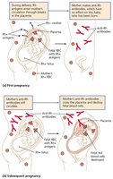 Rh incompatibility and hemolytic disease of the newborn