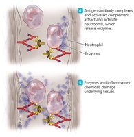 Neutrophil-mediated tissue damage in Type III hypersensitivity